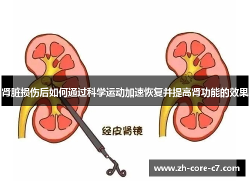 肾脏损伤后如何通过科学运动加速恢复并提高肾功能的效果